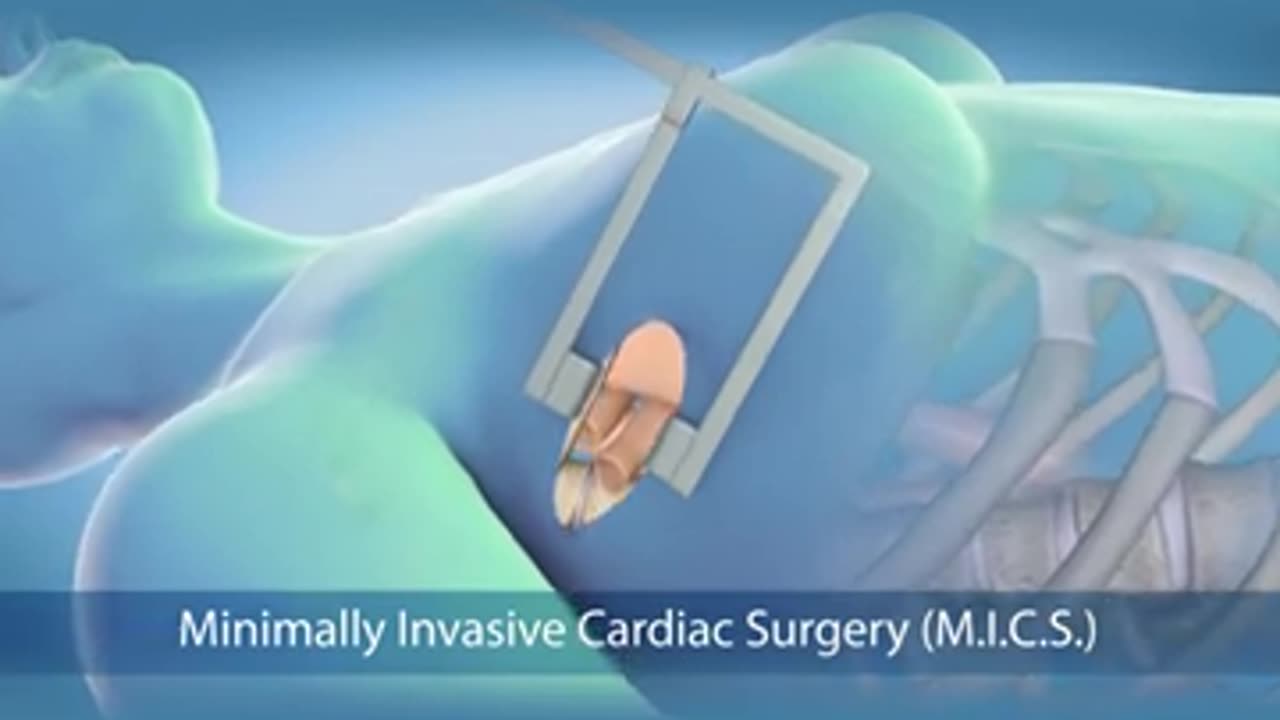 Venous Leak Treatment