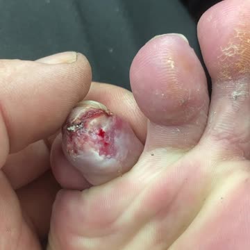 In one way it looks better in another not so much