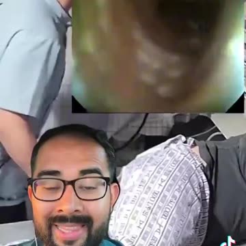 Colonoscopy removing a parasite. When last did you deworm?