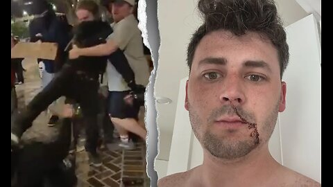 Cam Higby Punishes Leftist Agitator After Violent Attack, DOJ Investigation Follows