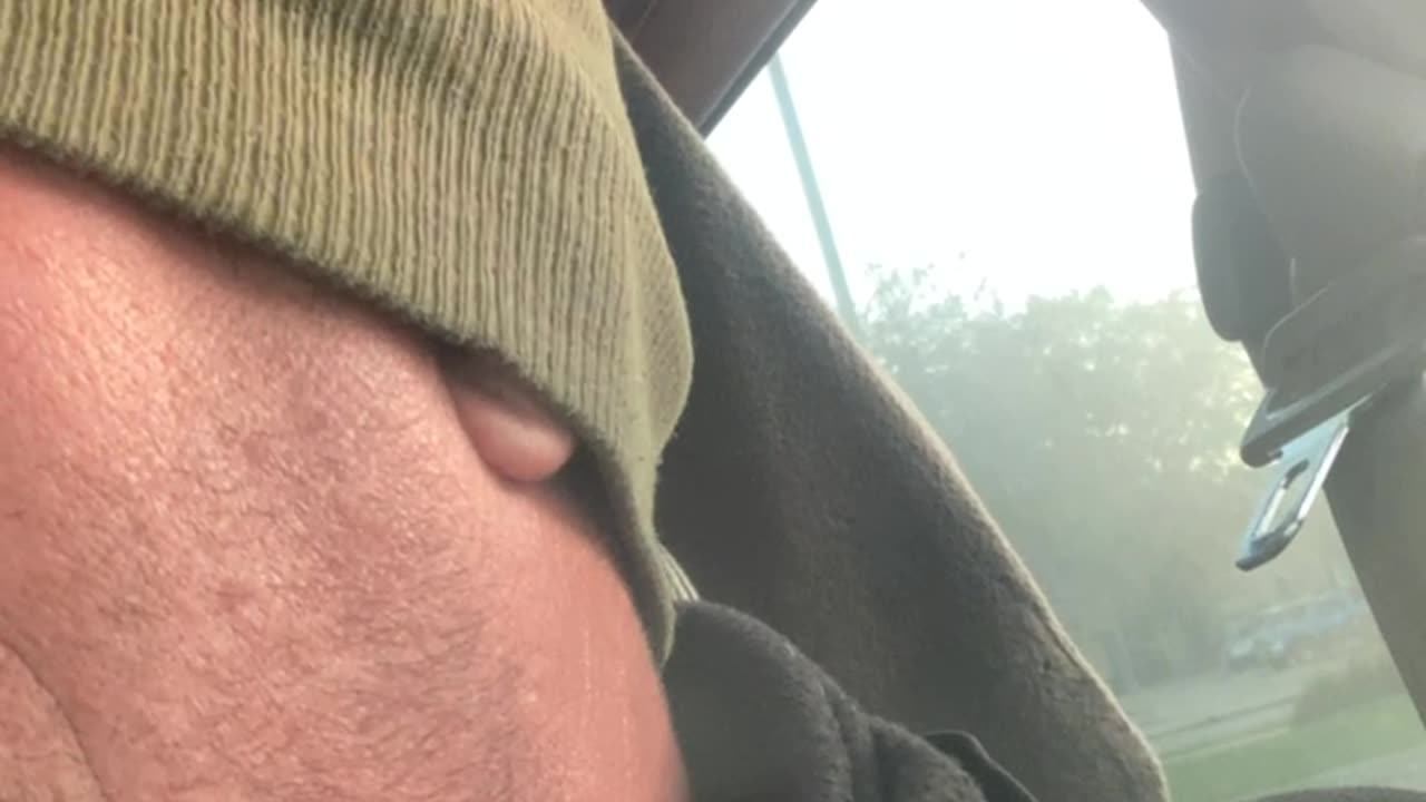 Catholic priest bites, lesbian