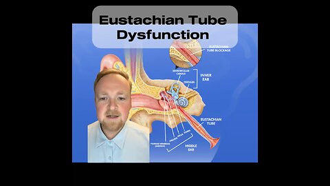 Natural relief for inner ear pressure | Natural Eustachian tube dysfunction treatment