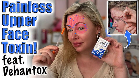 Painless Upper Face Toxin, Mapping, Depth and Units! AceCosm.com and code Jessica10 Saves you Money