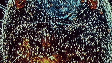 There’s a Tiny Mite Colony Living on Your Face