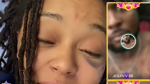 DINA NTYCE SUFFERS BROKEN CHEEKBONE & BLACK EYE AFTER BEING BEATUP BY CAR DOOR