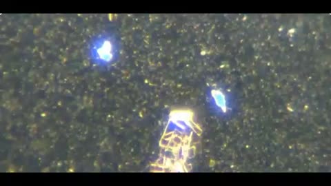 1 микророботы в крови