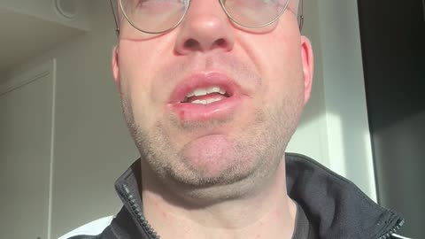 P2 #043 - Crappy Cobra & Cereal Problem