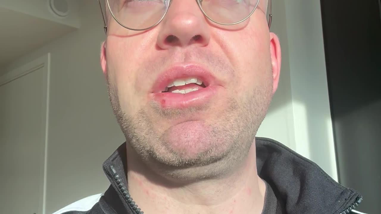 P2 #043 - Crappy Cobra & Cereal Problem