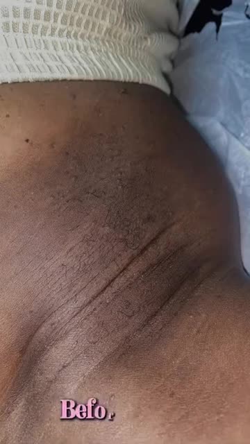 Underarm Waxing Before & After with Sexy Smooth Cherry Desire Hard Wax by @gentlysoothed