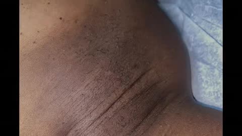 Underarm Waxing Before & After with Sexy Smooth Cherry Desire Hard Wax by @gentlysoothed