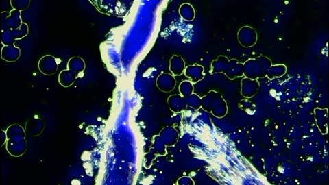 Ria No More Silence - structures in the blood of the covid vaccinated