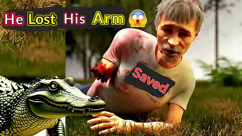 He Survived An Alligator Attack 😱