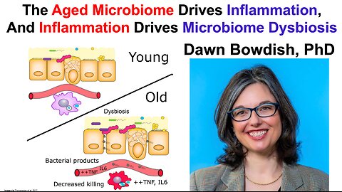 The Aged Microbiome Drives Inflammation, And Inflammation Drives Microbiome Dysbiosis