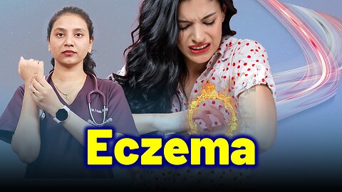 Eczema, Atopic Dermatitis . | Treatment & Cure | Homeopathy, Medicine & Surgery