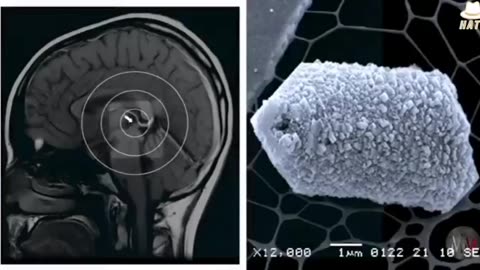 A Detailed Exploration of the Pineal Gland (Third Eye)