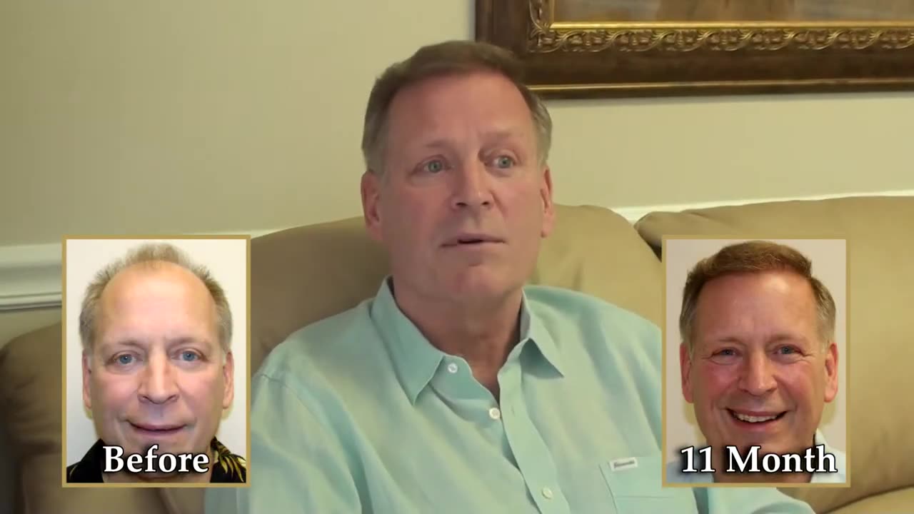 Life-Changing Hair Transplant Results | Dr. Brett Bolton