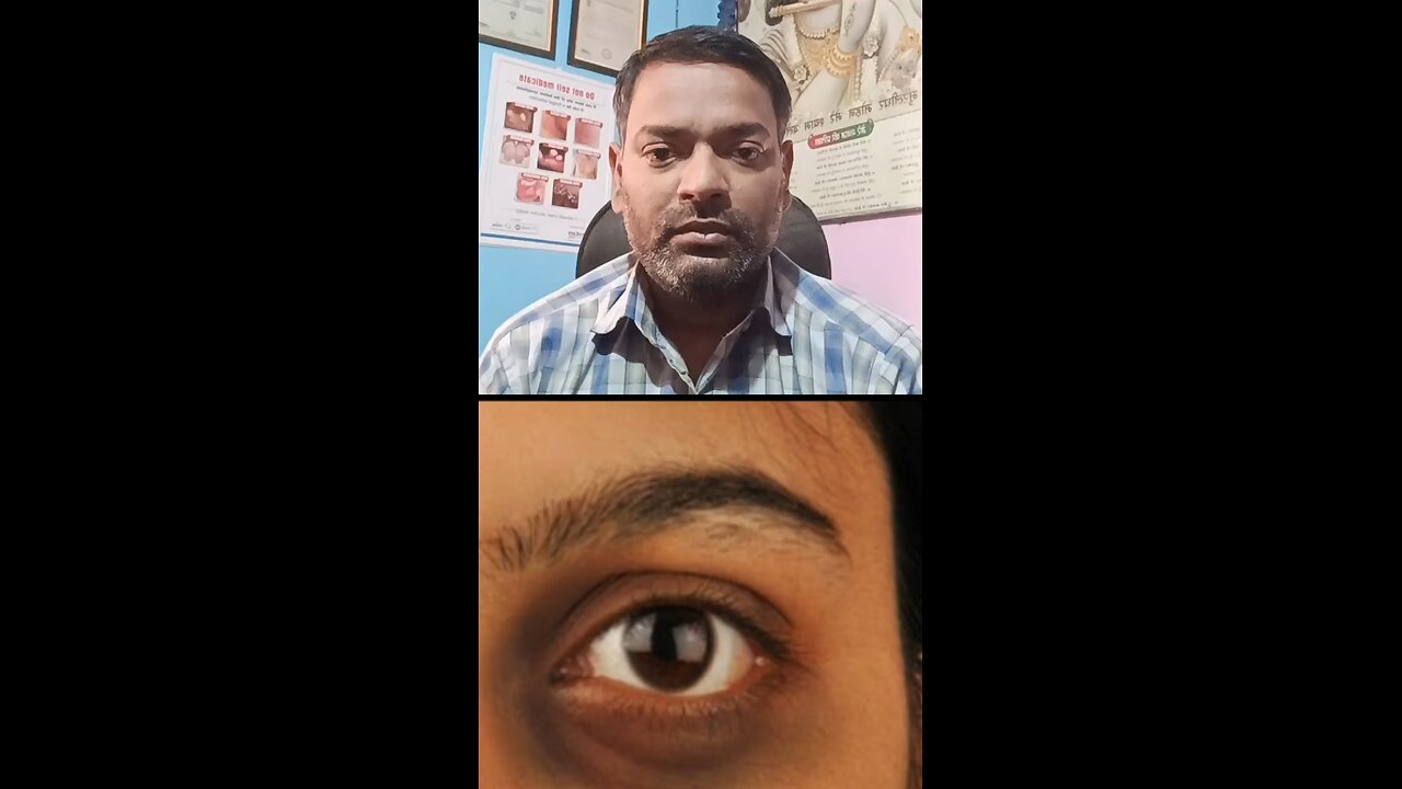 Dark circles treatment ।