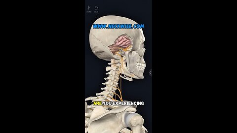 Burning pain at the bottom of your skull? | Neck Pain | Neckwise