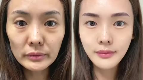 To achieve your ideal skin