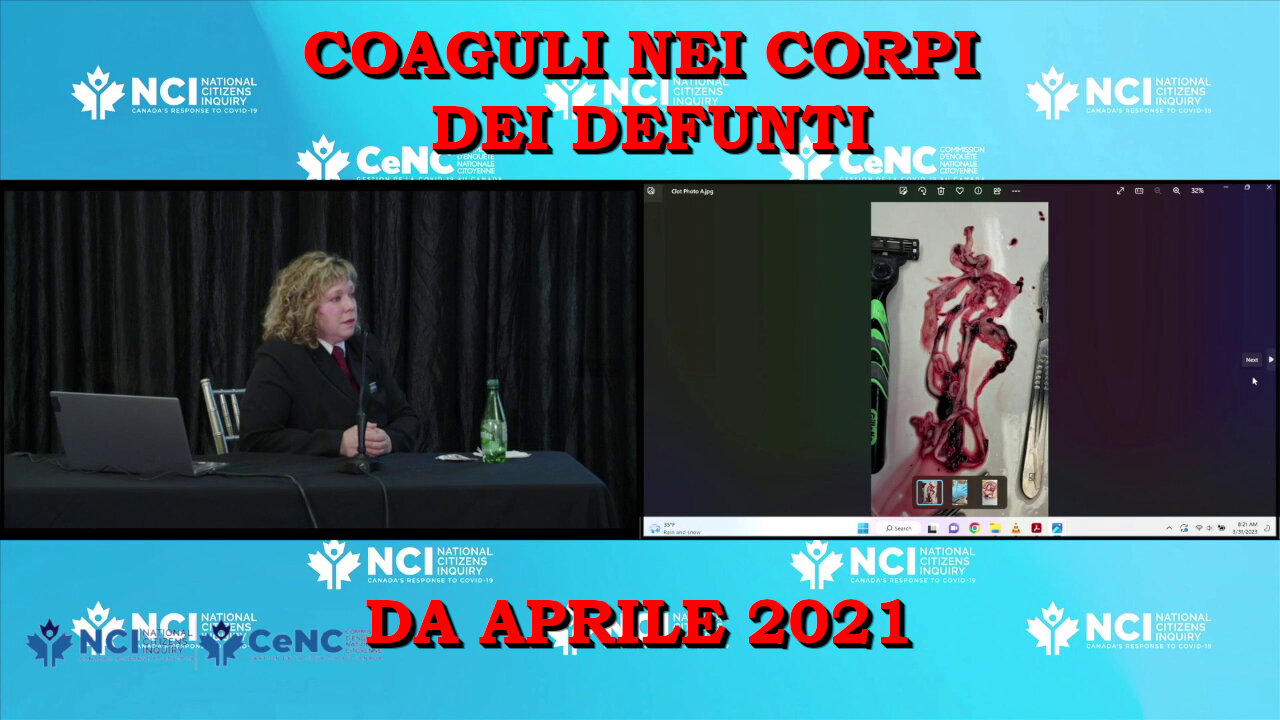 Coaguli nei corpi dei defunti da aprile 2021.