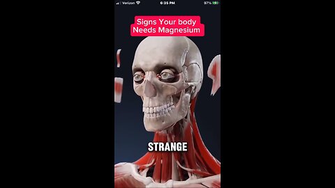 Signs your body need magnesium👇🏽