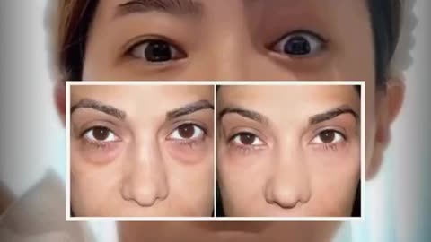 Massage Secrets for a Radiant Lineless Complexion 🥰