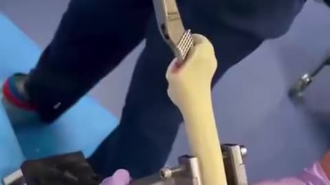How hip replacement surgery is 🧐done
			