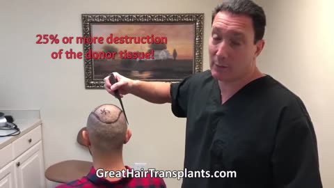 Short Video: What Every Patient Should Know Before Choosing FUE