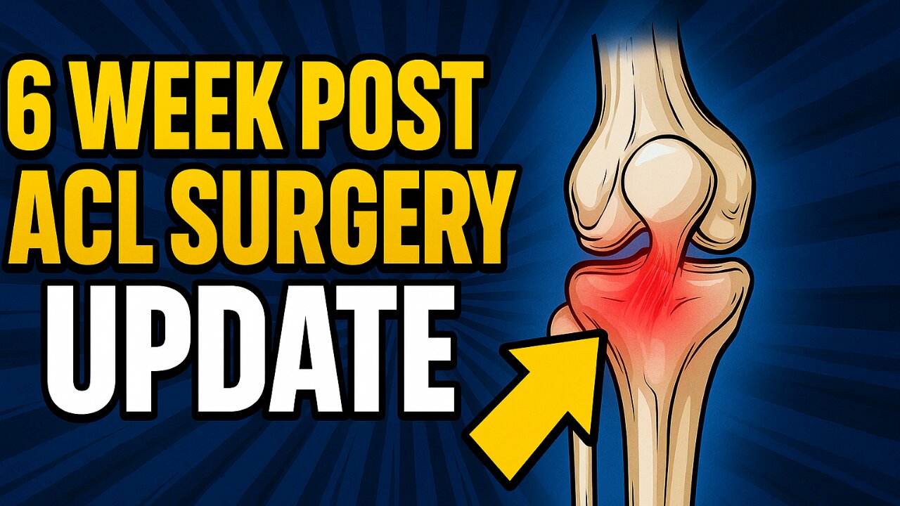 Week 6 ACL Surgery Recovery Update