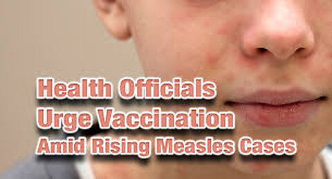 Measles - More Fear Porn Being Pushed By Medical Industry