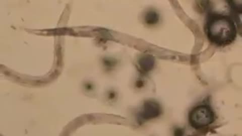 Baking soda versus parasites