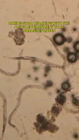 Baking soda versus parasites