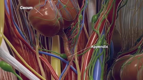 Appendix Removal Surgery (Appendectomy)