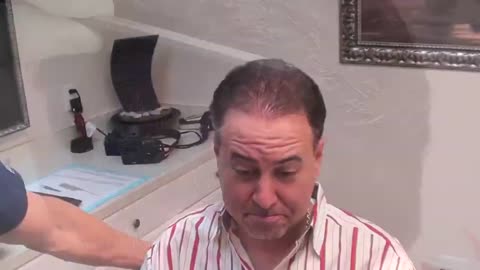 Dr. Brett Bolton Shows Undetectable Hair Restoration Scar
