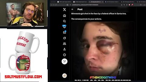 ICE Rioter Claims He's Blind in One Eye After Federal Officer Shot Him ~ Salty Cracker 1.14.26