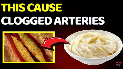 5 Surprising Blood Flow Blockage Culprits Hiding In Your Daily Meals.