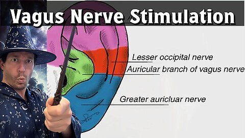 Dry Needling & Electrical Vagus Nerve Stimulation- Part 1