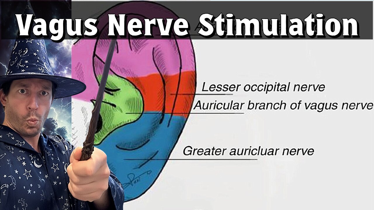 Dry Needling & Electrical Vagus Nerve Stimulation- Part 1