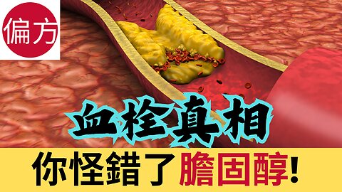 膽固醇不是你想像的那樣!!