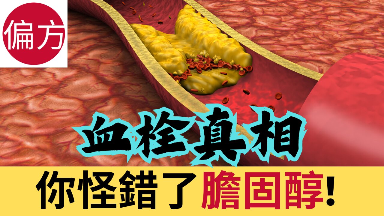 膽固醇不是你想像的那樣!!