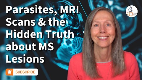 Parasites, MRI Scans, and the Hidden Truth About MS Lesions