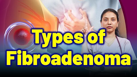 Types of Fibrodenoma | Treatment Cure Medicine Surgery | Gynaecology Women Female | Homeopathy