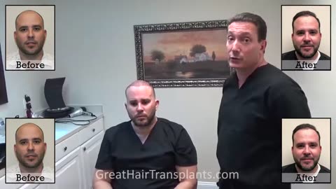 Adrien’s MaxHarvest™ Plus Hair Transplant – 3-Day Post-Op with Dr. Brett Bolton