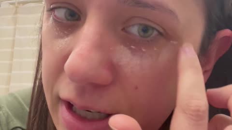 How to Finally Get Rid of Dark Under Eye Circles