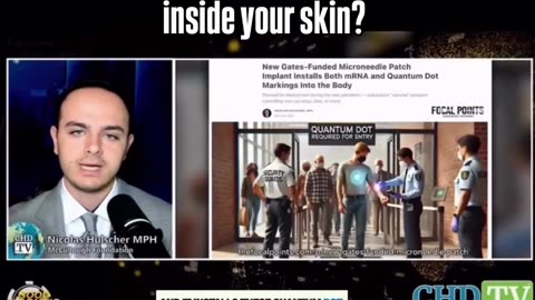 BEWARE, from jabs to micro-needle patches ..... The mark of the beast.