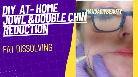 DIY- Jowl & Double Chin Reduction- Lipolab PPC Fat Dissolver