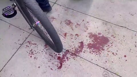 Pedestrian Attacked, Kid Stabbed at Protest against Immigration Enforcement in Los Angeles 🔪