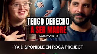 EUGENESIA PURA: El 95% de personas con Síndrome de Down es asesinada con el Aborto