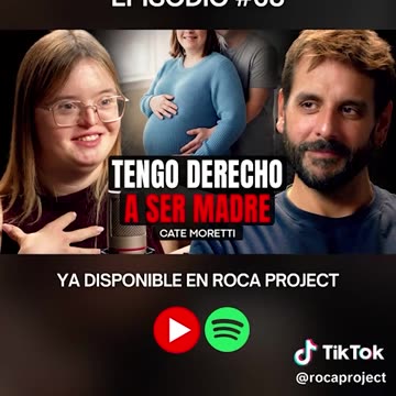 EUGENESIA PURA: El 95% de personas con Síndrome de Down es asesinada con el Aborto