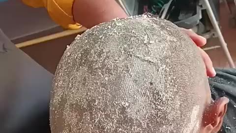 Viral: dandruff #dandruff #haircut #hairstyle #hair #trending #viral #youtubesho